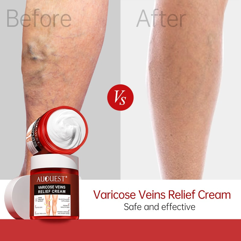 Varicose Vein Treatment Cream | Varicose Relief Cream | Deep Cleansing