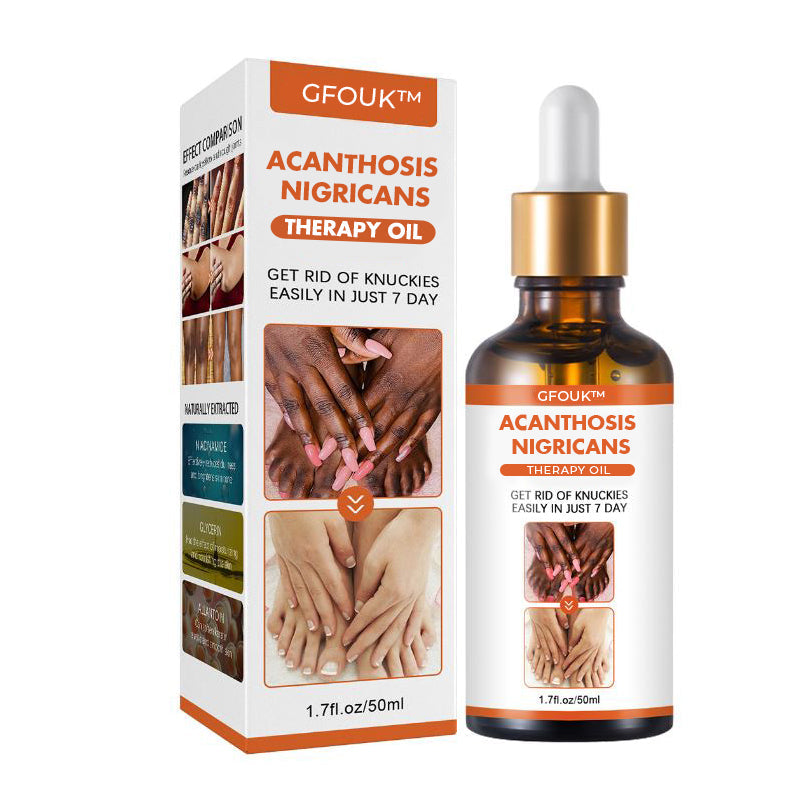 Acanthosis Nigricans Treatment Oil | Get Rid Dark Neck| Deep Cleansing