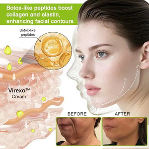 Botox & Vita-A Retinol Shot Wrinkle-Lift Tightening Cream – DEEPCLEANSING