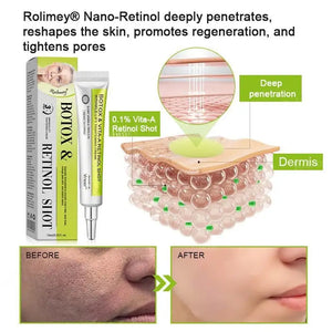Botox & Vita-A Retinol Shot Wrinkle-Lift Tightening Cream – DEEPCLEANSING