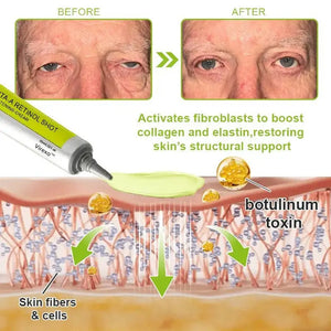 Botox & Vita-A Retinol Shot Wrinkle-Lift Tightening Cream – DEEPCLEANSING