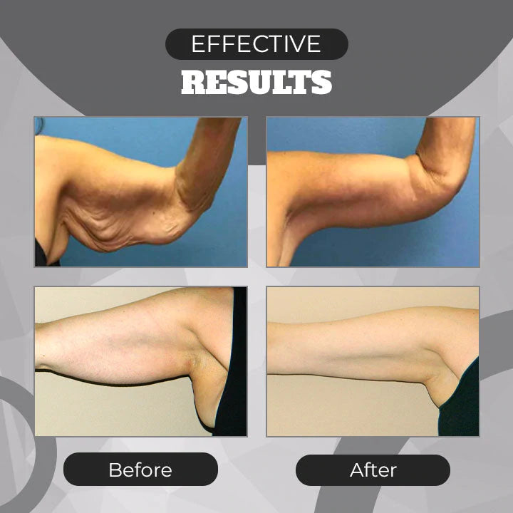 Magnetic Lymph Detox Bracelet