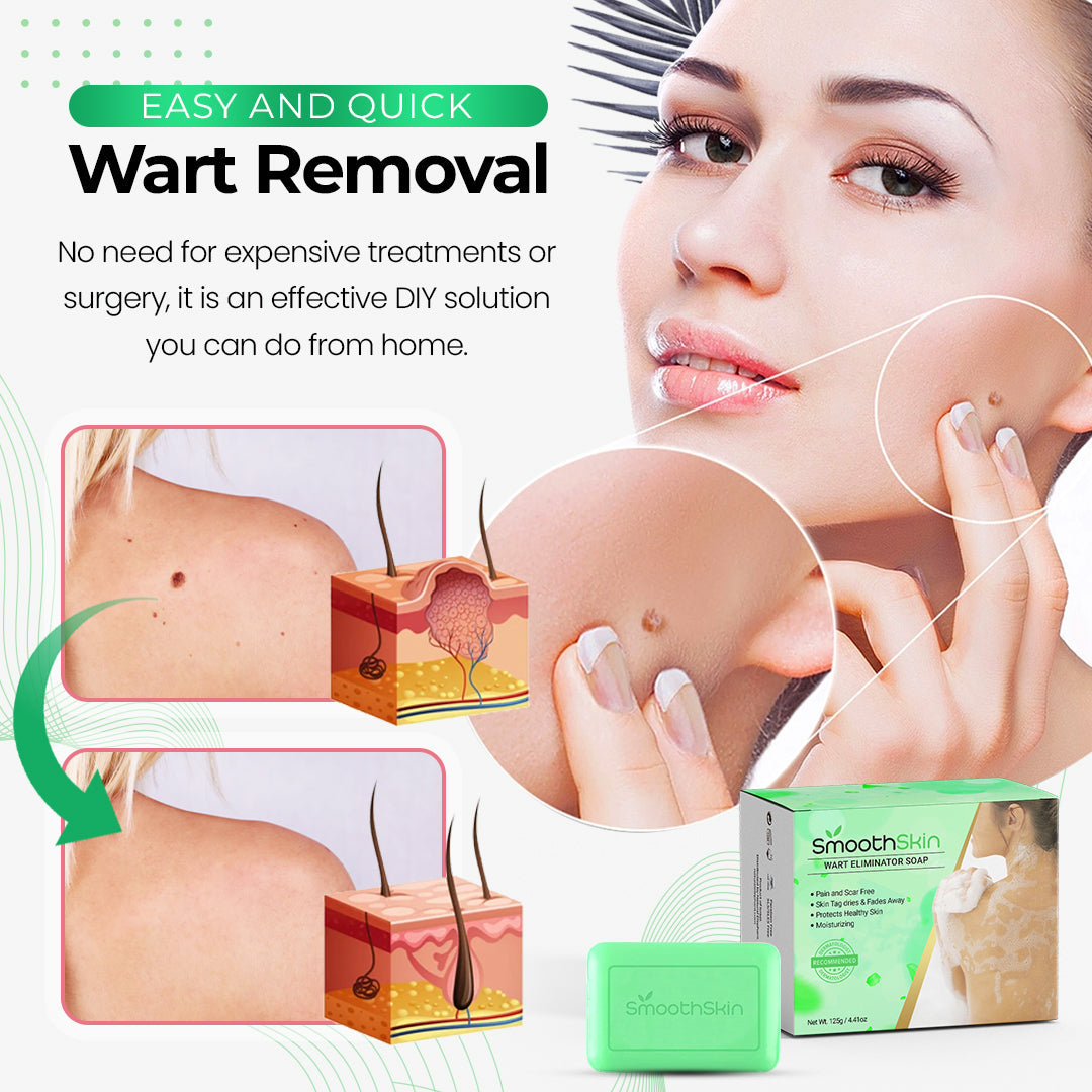 Best Wart Remover