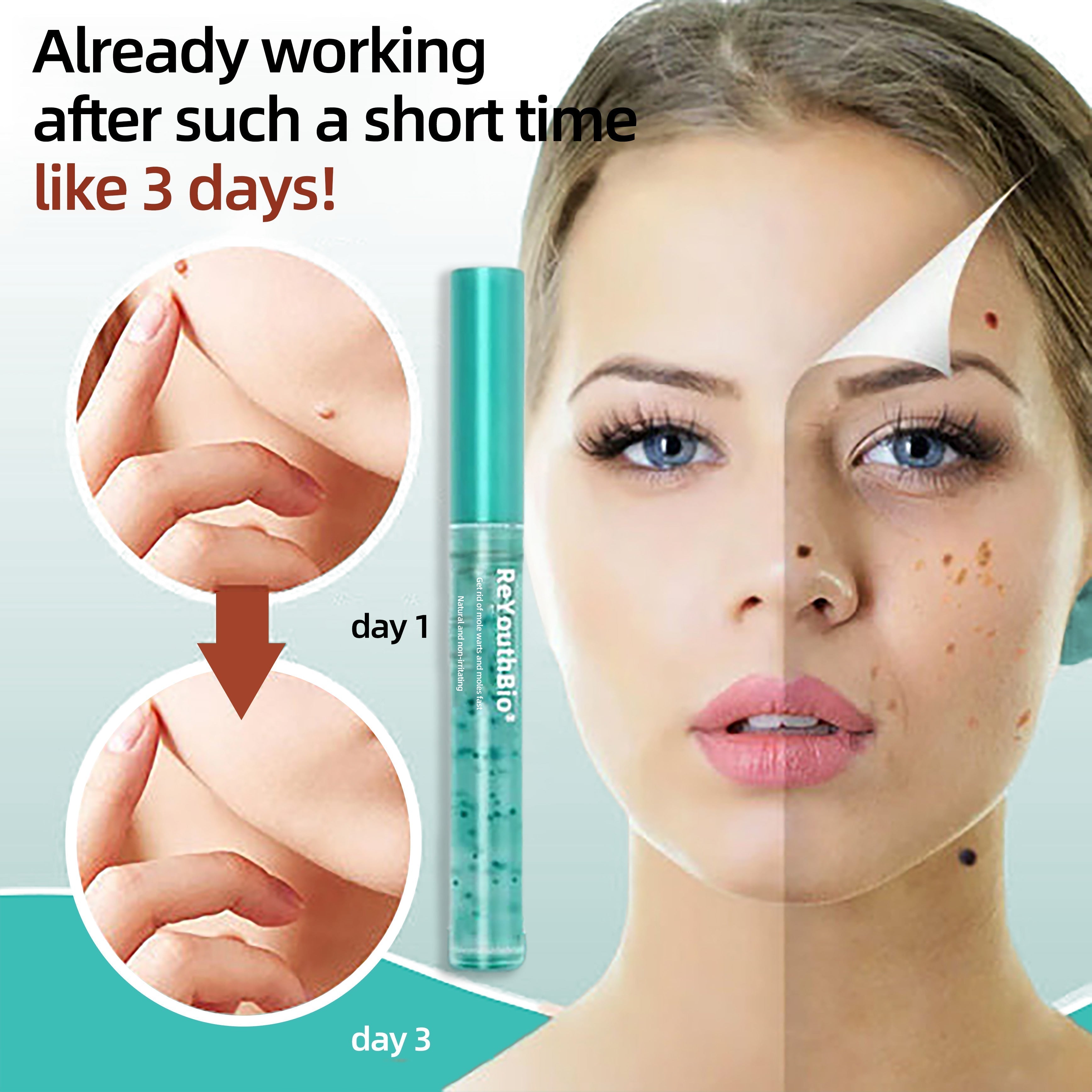 Tags & Moles Remover