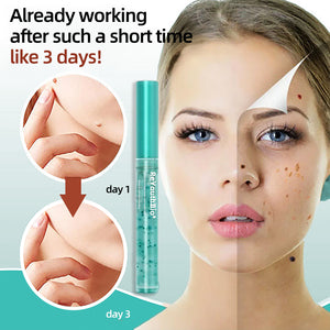 Tags & Moles Remover