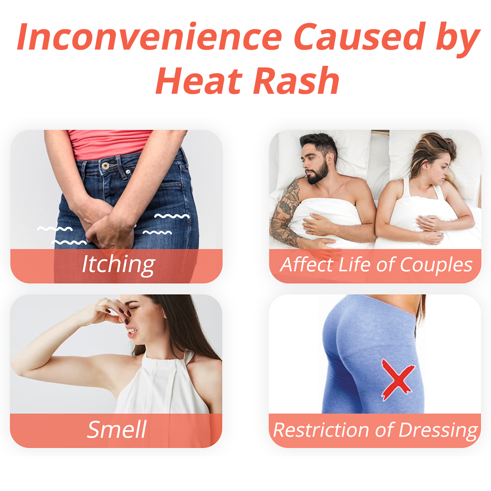 Heat rash cream deals