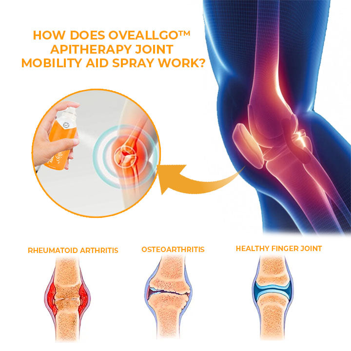 CC™ Apitherapy Joint Mobility Aid Spray (Full Body Recovery)